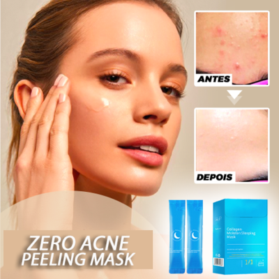 Zero ACNE Peeling Mask